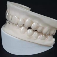 3D打印技术在牙科领域的应用