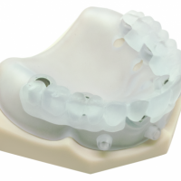 3D打印技术在数字化牙科种植中的运用情况